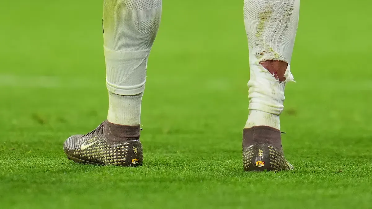 Baccara Gaming-球袜被直接踢破！姆巴佩遭拜仁后卫塔犯规后，血痕清晰可见